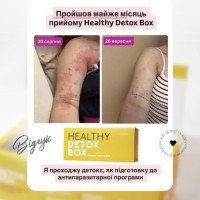 Healthy Box от Choice — программа поддержки организма (Хитозан, Брейкблок, Ливсейф, Ф.Актив, Lym Drain & Detox)