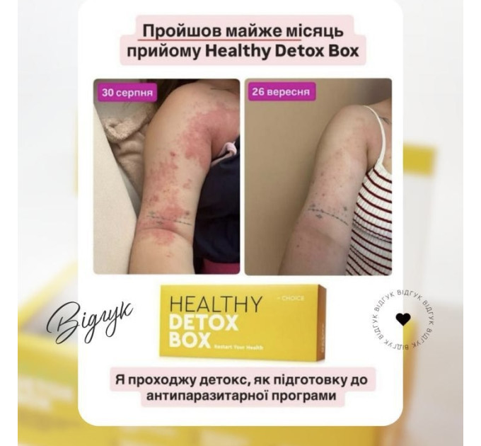 Healthy Box від Choice — комплексна програма підтримки організму