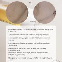 Тоник антиакне от Choice Тоник антиакне от Choice