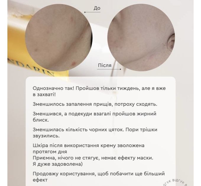 Гель-мусс для проблемной кожи Gel Mousse Active – Очищение, баланс кожного сала