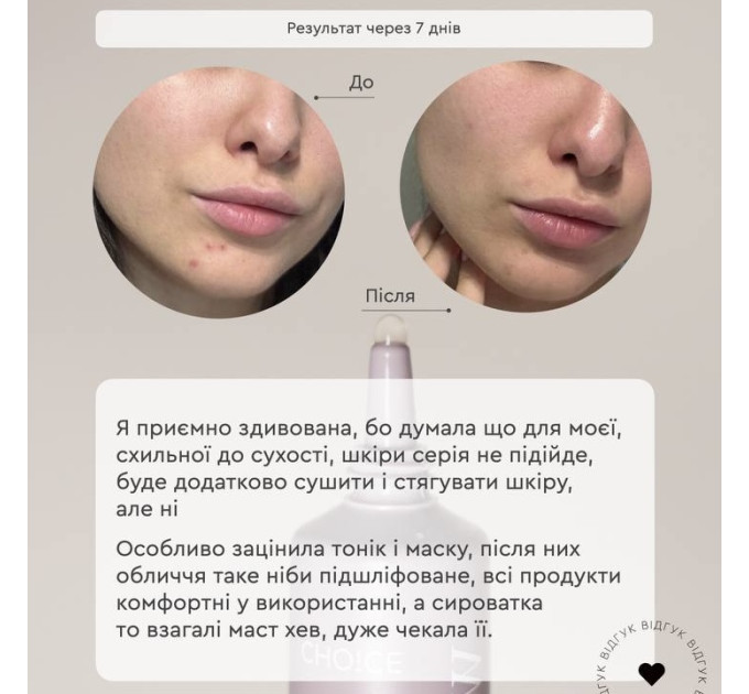 Гель-мусс для проблемной кожи Gel Mousse Active – Очищение, баланс кожного сала