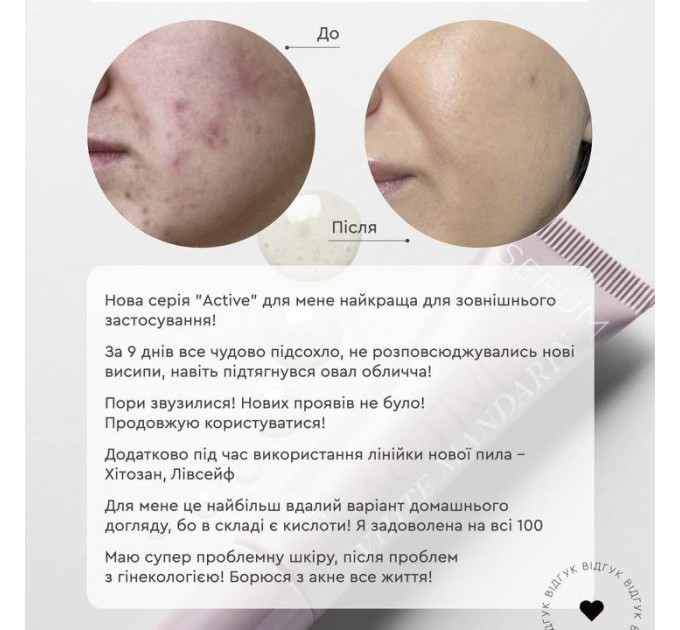 Гель-мусс для проблемной кожи Gel Mousse Active – Очищение, баланс кожного сала