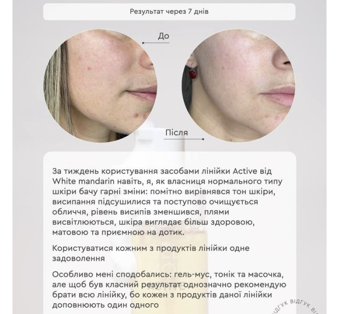 Гель-мусс для проблемной кожи Gel Mousse Active – Очищение, баланс кожного сала